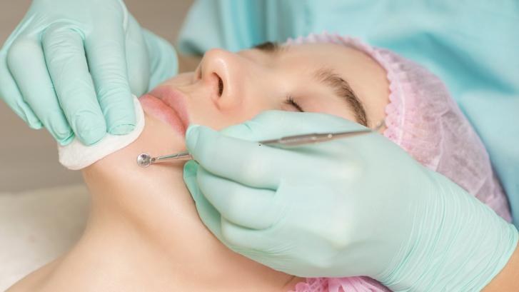 Whitehead Extraction at a Leonardtown Maryland Dermatologist